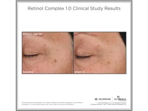 Skinmedica Retinol Complex