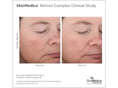 Skinmedica Retinol Complex